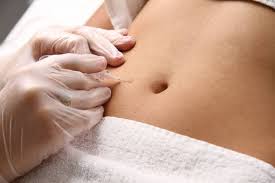 Carboxiterapia em Duque de Caxias